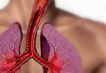 Estratégias nutricionais para doentes com Asma nutrição e asma