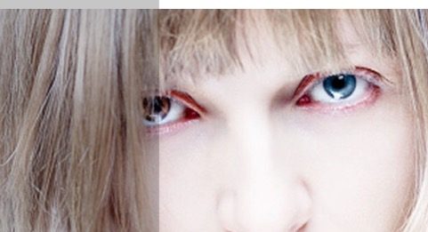 Alimentação e anemia alimentação_anemia