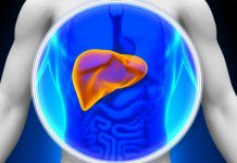 Esteatose hepática, o que comer e o que evitar Esteatose hepática