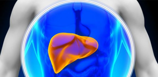 Esteatose hepática, o que comer e o que evitar Esteatose hepática